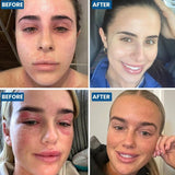 Gesicht & Augenlid Ekzem Creme - Grahams Natural