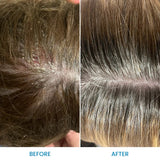 Grahams Natural - Kopfhaut Beruhigungs - Creme - Besonders beliebt - Dermatitis - Psoriasis - 2