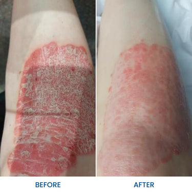 Grahams Natural - Körper & Bade Öl - Besonders beliebt - Dermatitis - Neurodermitis - 2